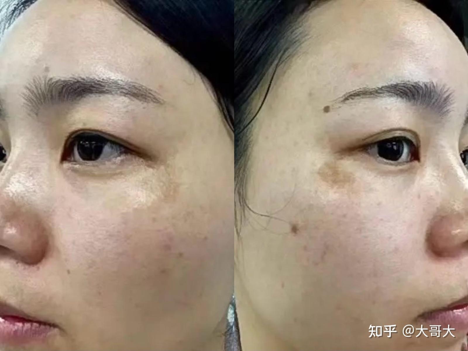 最新捕捉斑現(xiàn)象，多維視角深度解析